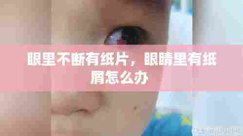 眼里不断有纸片，眼睛里有纸屑怎么办 